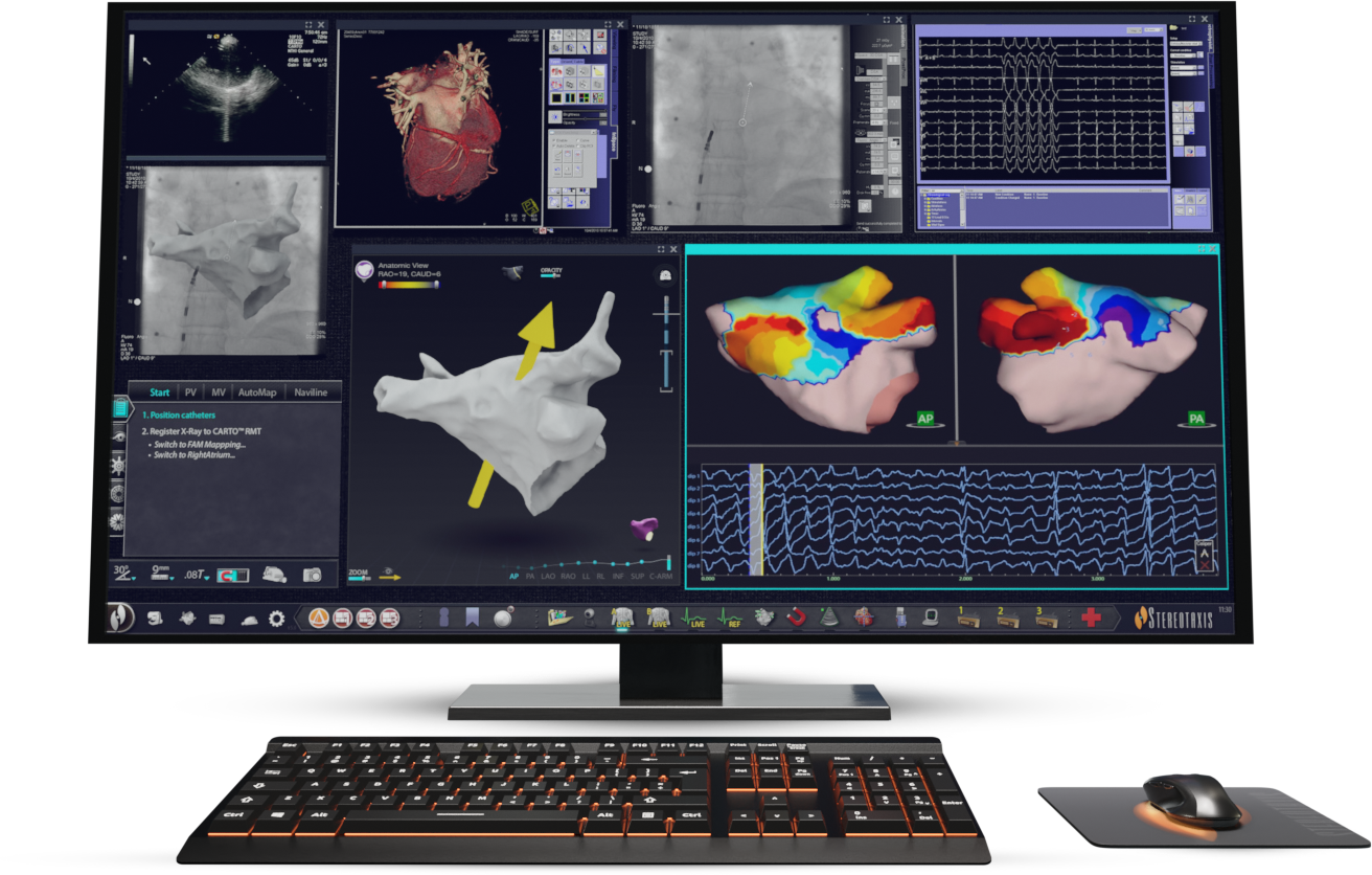 Odyssey Robotic Magnetic Navigation Screen